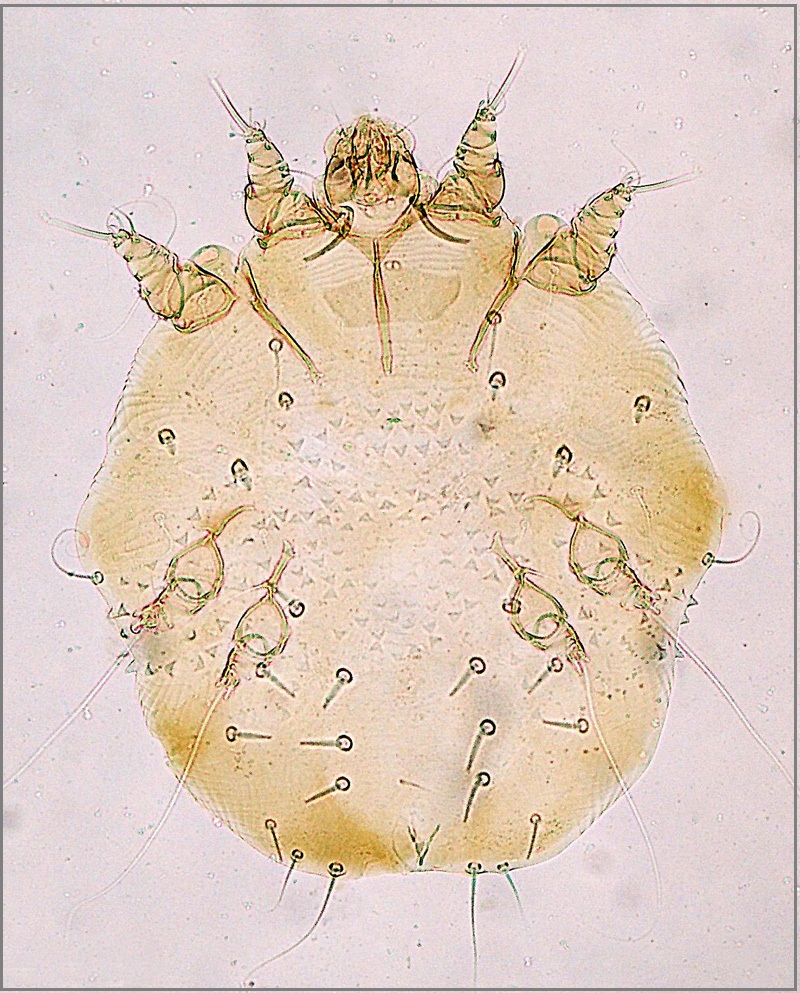 Sarcoptes-scabiei-adult-mite-2