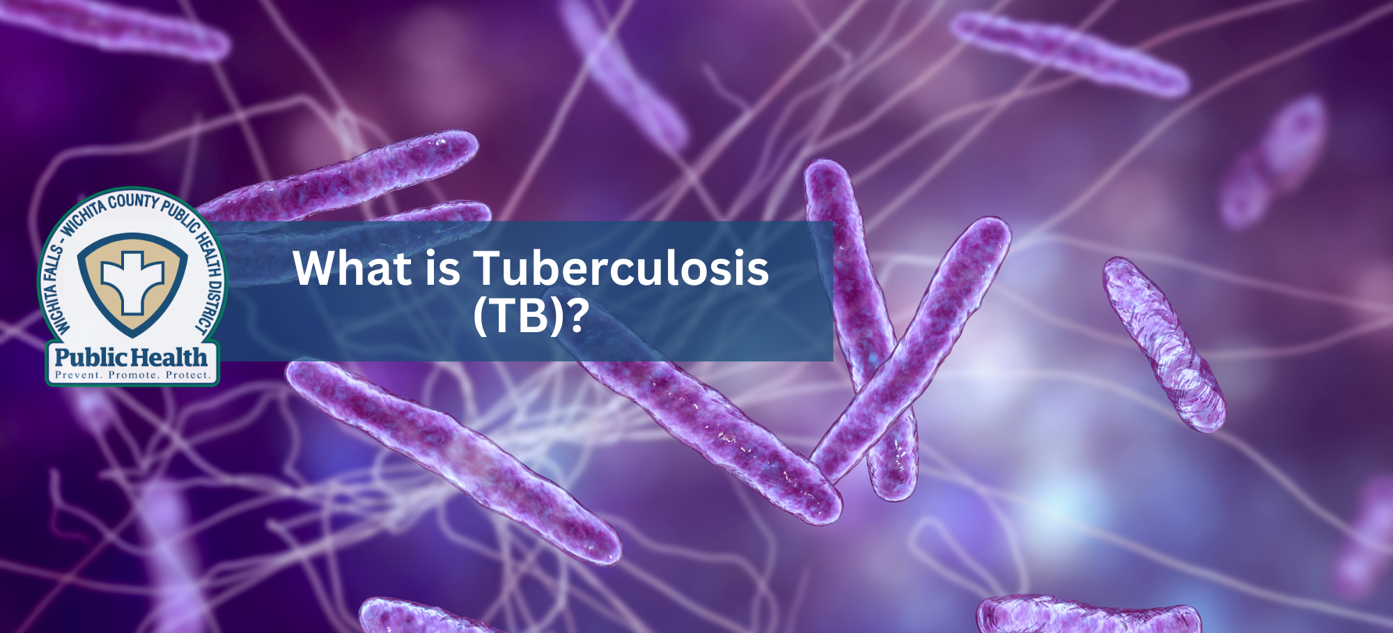 What is TB 1